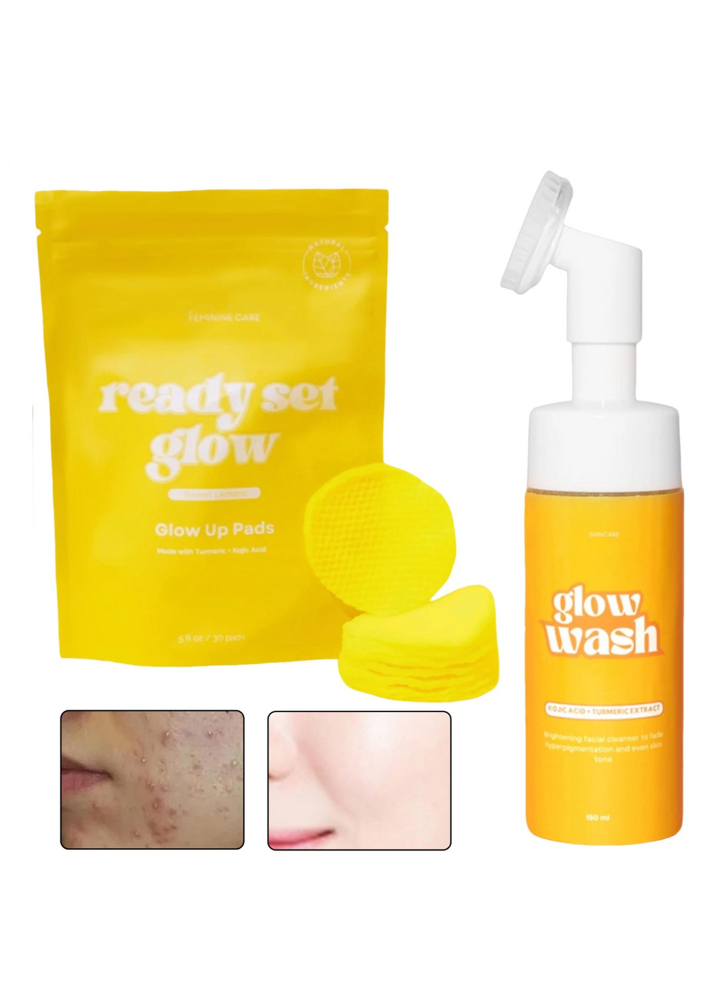 Turmeric Face Wash+Turmeric Cleansing Pads,100% Natural Turmeric Cleansing set